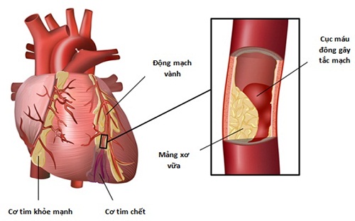 Các bệnh gan nguy hiểm cần phải biết
